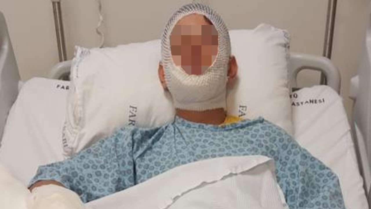 Trabzon’da korkutan olay: Isınmak için yaktığı ateşe benzin dökünce alevler içinde kaldı