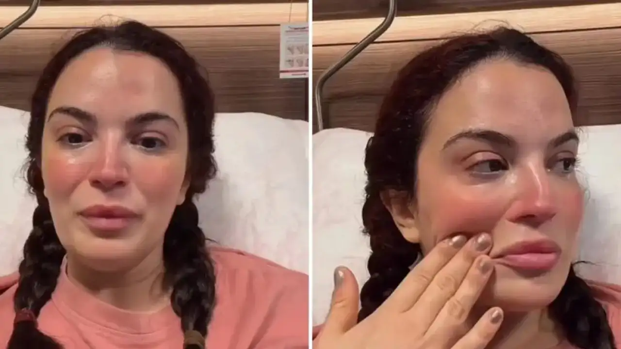 Aslı Bekiroğlu gözyaşlarıyla anlattı! 6’ncı kez ameliyat oldu, bir operasyon daha geçireceğini açıkladı