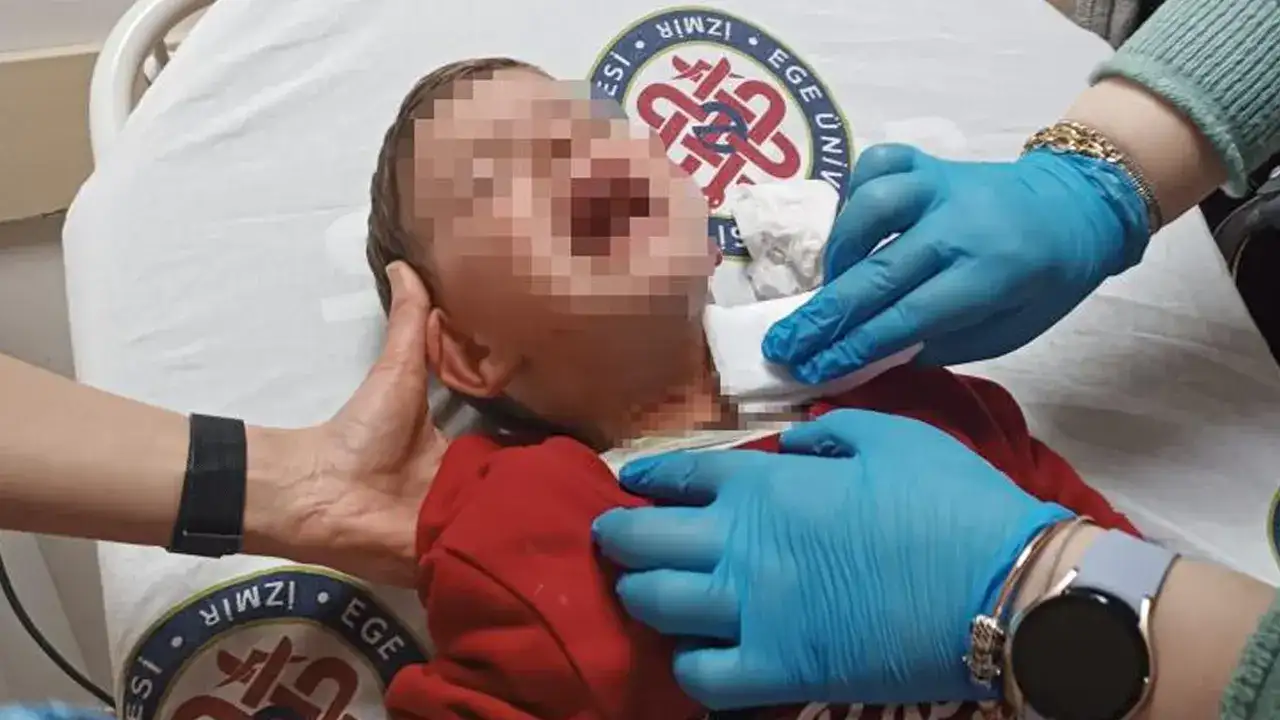 Parkta oynayan 2 yaşındaki çocuk bıçaklı saldırıda yaralandı