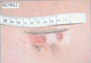 Tıp dünyası şoka girdi