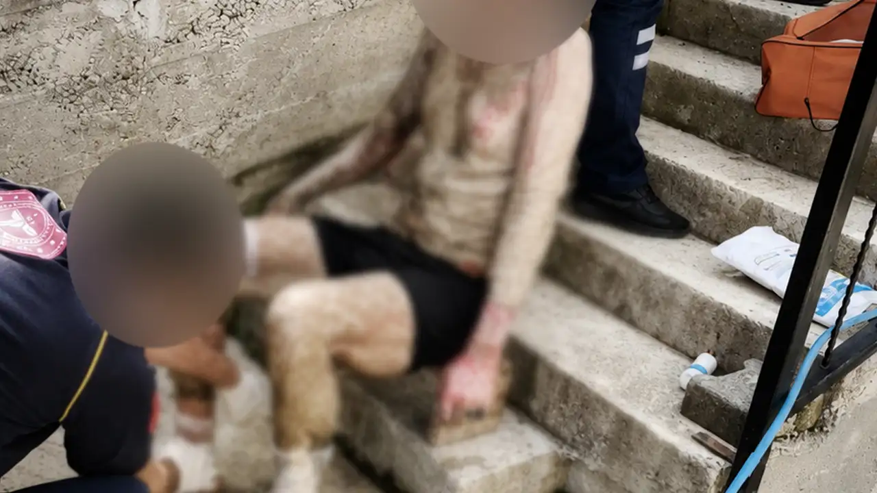 Trabzon’da şok olay! Üzerine benzin döküp kendini ateşe verdi