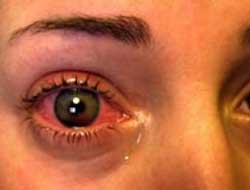 Bütün köy kör oldu!