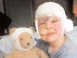 Rottweiler, çocuğu öldürüyordu