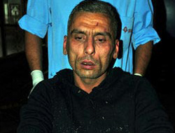 Ölmedi diye meydan dayağı