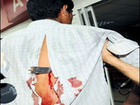 Babasını 30 yerinden bıçakladı!