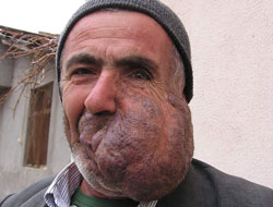 Bu adama tıp bile çare bulamıyor