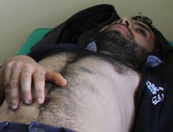 Parmakları karnına dikildi!