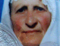 Trabzon'da yanan kadın öldü!