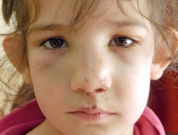 Sen misin kızımı döven!