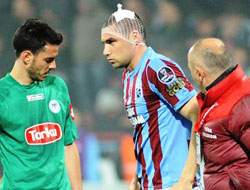 Burak kanama şüphesini atlattı