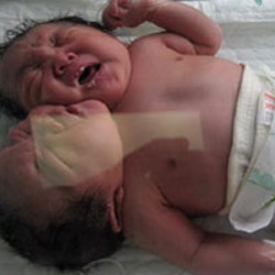 İnanılmaz ama gerçek!