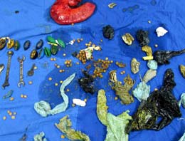 Midesinden çıkanlar şoke etti!