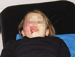 Kızını evinin balkonundan attı!