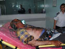 Çobanın üzerine yıldırm düştü