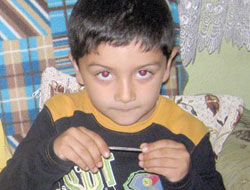 Bu çocuk tornavidayı yuttu!