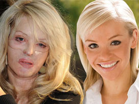 Yanan yıldıza Türk cerrah dokundu