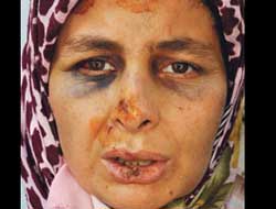 Devlet O'na sonunda kucak açtı