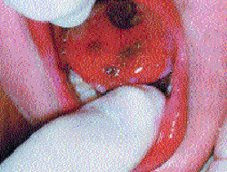 Su Yerine Çamaşır Suyu verdi!