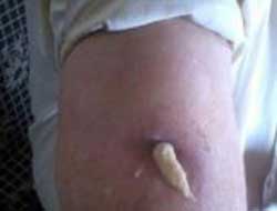 Bakın hastanın içinde ne unuttular