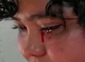 Resmen kan ağlıyor