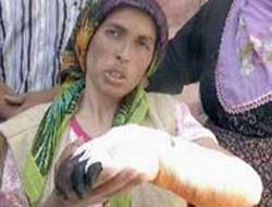 Bebek beklerken kol verdiler