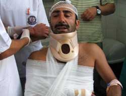 Ünlü oyuncu feci kaza yaptı