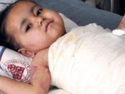 3 yaşındaki Merve kendini yaktı!