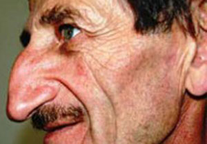 Artvinli burun şampiyonu dertli