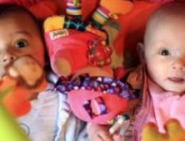 İkiz kardeşler ama farklı ırktan