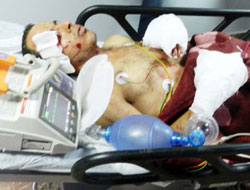 Bomba elinde patladı!