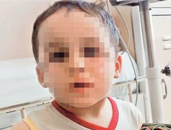 İşkence mağduru çocuk!