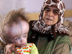 Küçük Eren hayatını kaybetti!