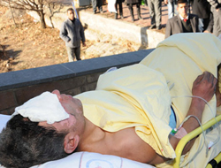 Lise tatbikatında öğrenci yandı