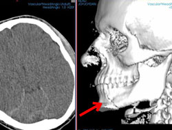 Jo Jo Dan pişman oldu