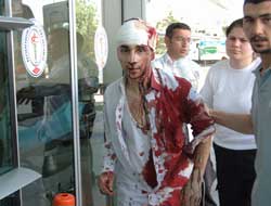 Kocasını sopa ile kovaladı!