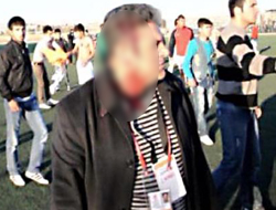 Maçta başkanın kafasını kırdılar