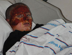 Bir anlık dalgınlık!