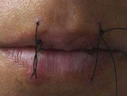 Mülteciler dudaklarını diktiler...