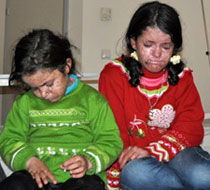 Güneşte kanser oldular!