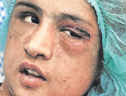 Çocuk gelin bu hale geldi!