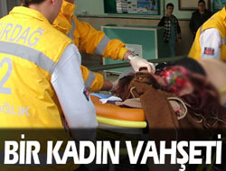 Sokak ortasında kadın vuruldu!