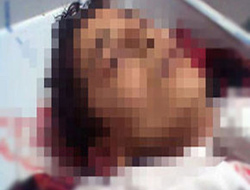 Testere ile boğazını kesti