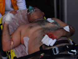 Gazeteye ilan verdi ne hale geldi!