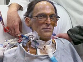 Dünyanın ilk 'kalpsiz' adamı!