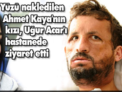 Türkiye'de ilk nüz nakli yapıldı