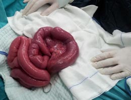 Bağırsaklarından çıkana bakın!