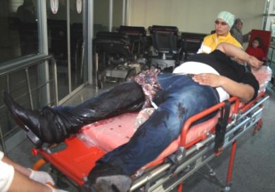 Taşla kafasına vurdular