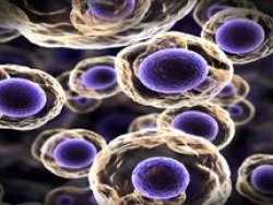 Kemoterapi tarih oluyor