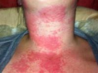 iPhone canından ediyordu