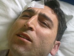 Şoförler öğretmeni darp etti !